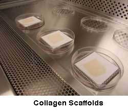 collagen scaffolds